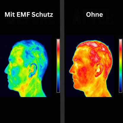 Quantum EMF Schutz Chip™